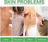 Jaysuing - L ' Body Acne Removing Essence